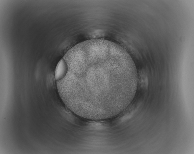 X0000111440523200908101017