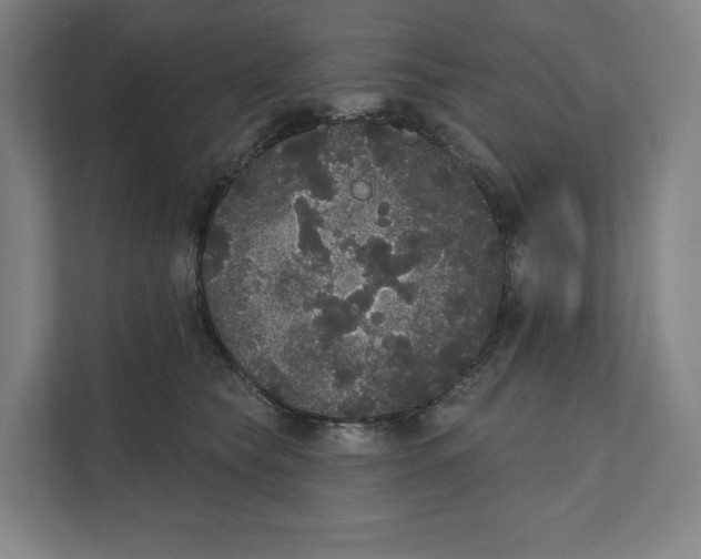 X0000111440565200908101017