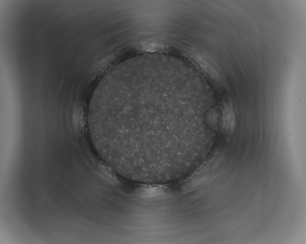 X0000111440569200908101017