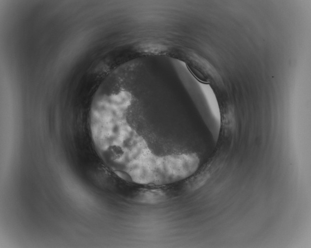 X0000111440572200908101017