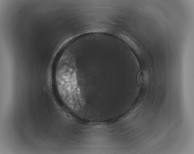 X0000111440676200908101015