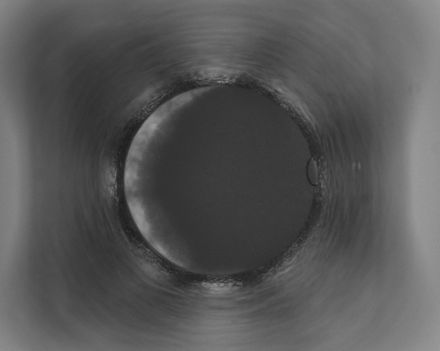 X0000111440693200908101015