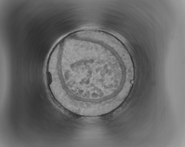 X0000111440864200908101013