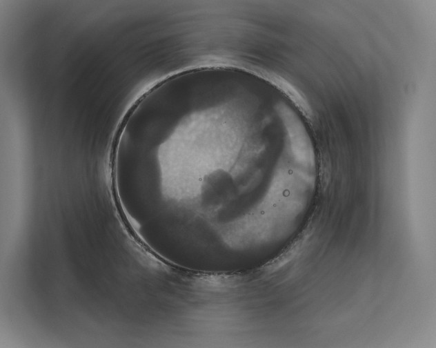 X0000111440950200908101012