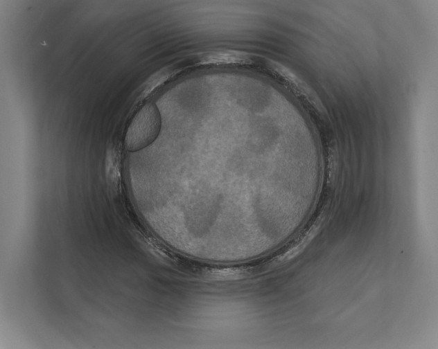 X0000111441017200908101010