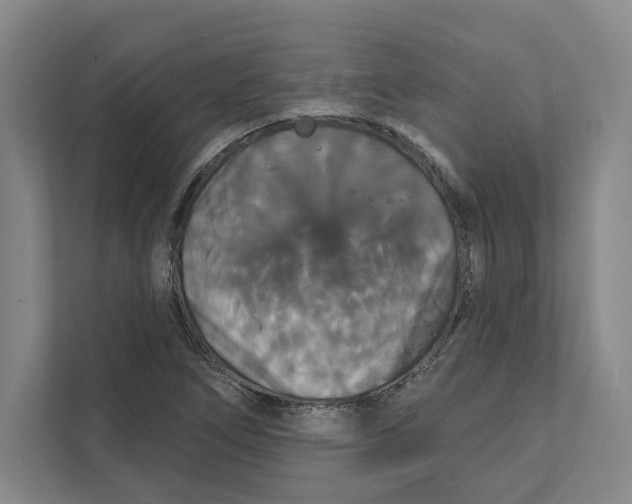 X0000111441266200908101007