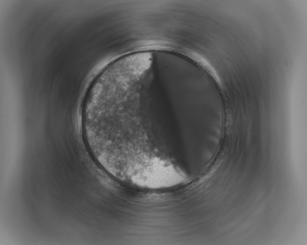 X0000111441419200908101005