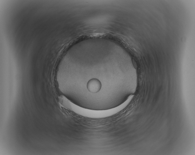 X0000111441441200908101005