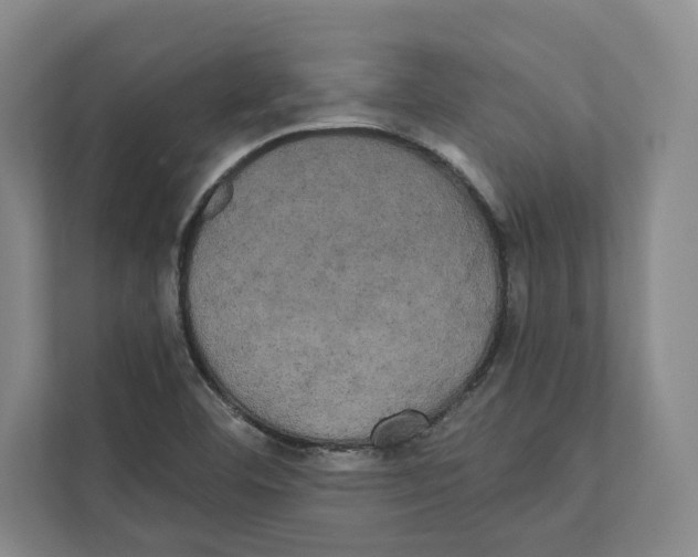 X0000111441460200908101005