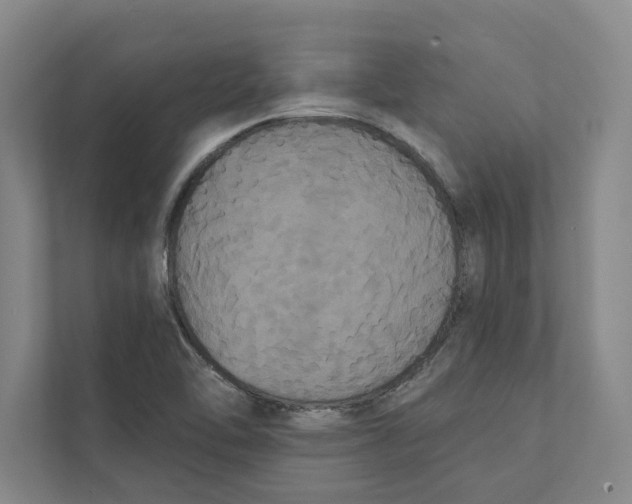 X0000111441462200908101005