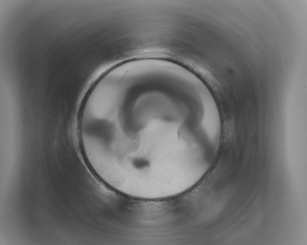 X0000111441470200908101005