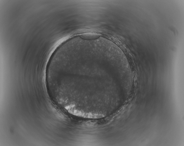 X0000111440148200908241151
