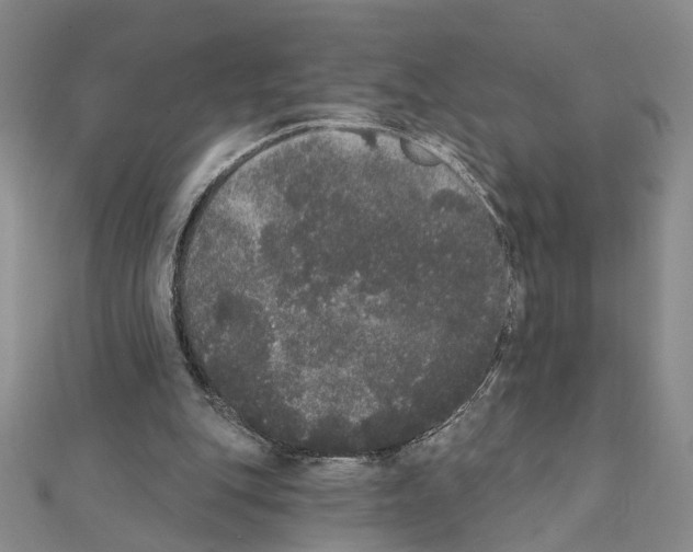 X0000111440151200908241151