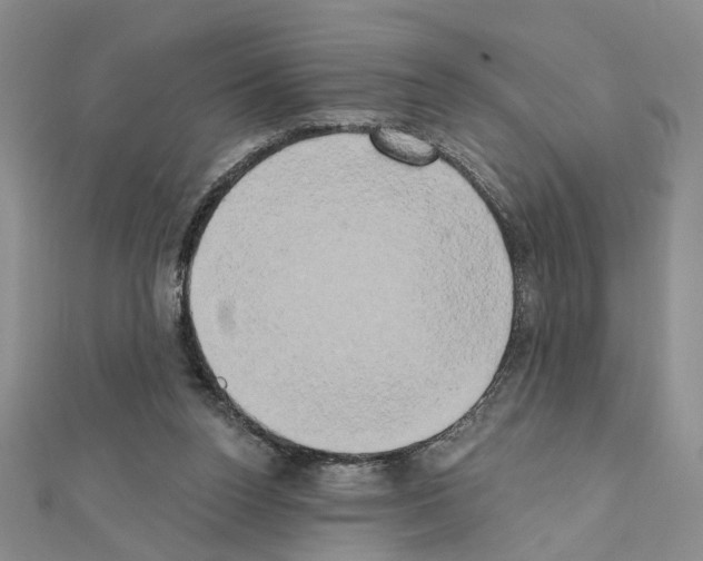 X0000111440160200908241151