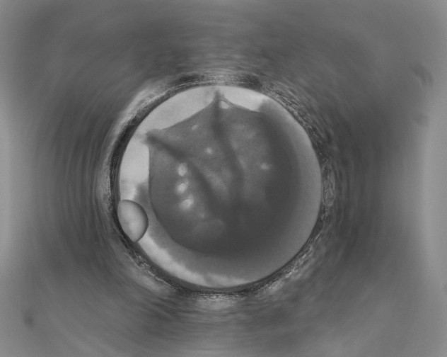 X0000111440198200908241151