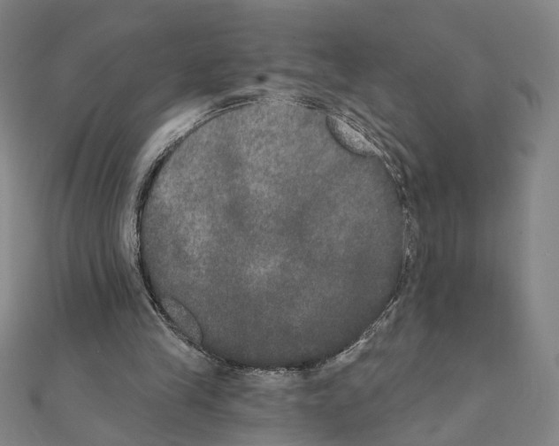 X0000111440245200908241150