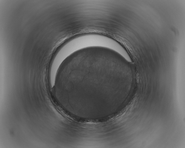 X0000111440352200908241149