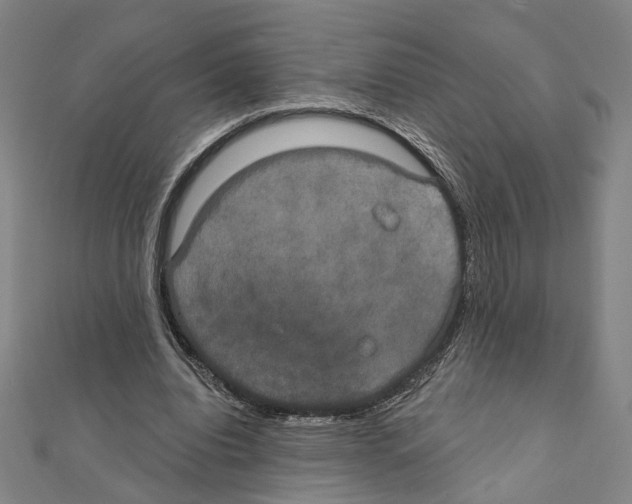 X0000111440440200908241147