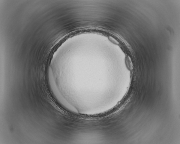 X0000111440969200908241140