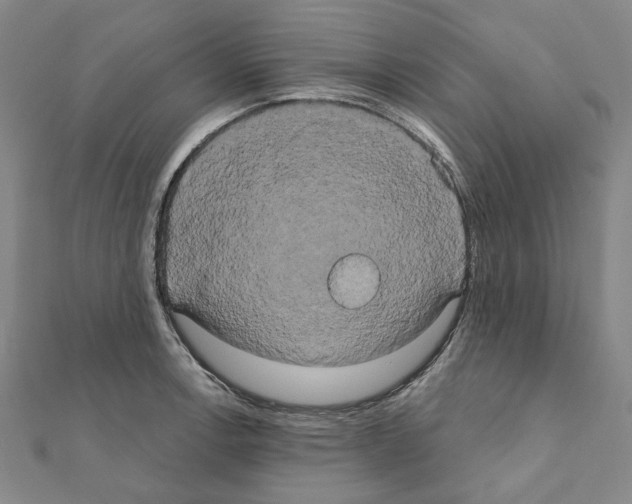 X0000111441138200908241138