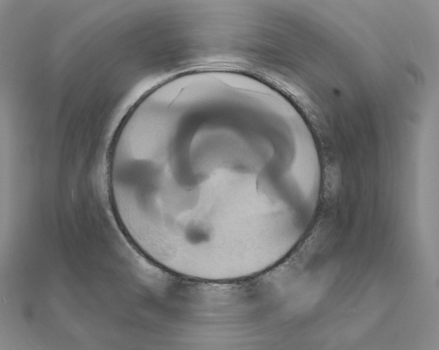 X0000111441470200908241133