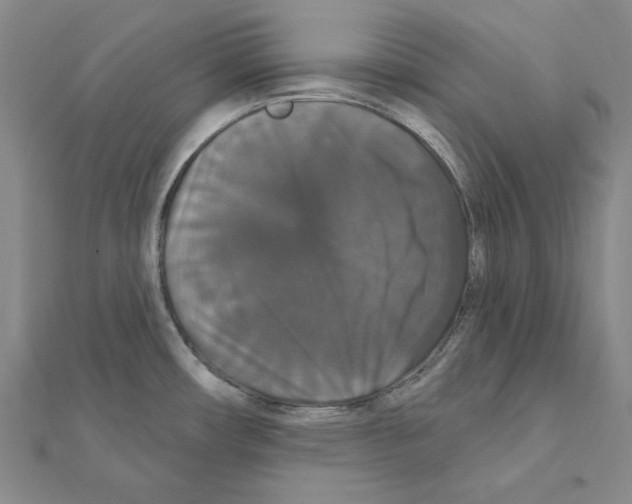 X0000111441482200908241132