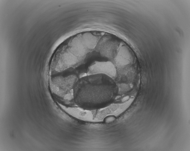 X0000111441522200908241132