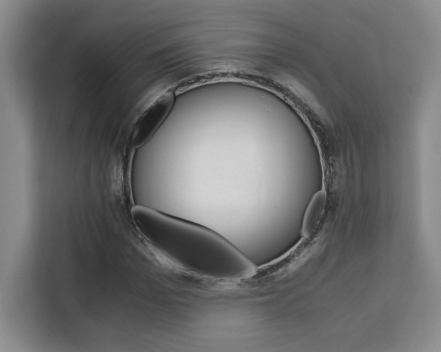 X0000111450969200907131037
