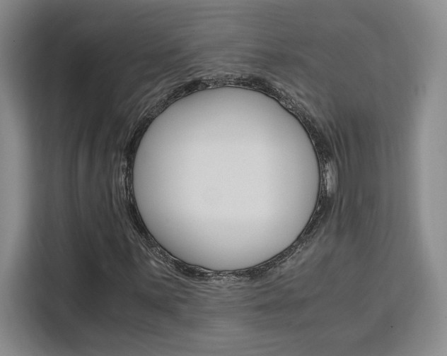 X0000111451059200907131036