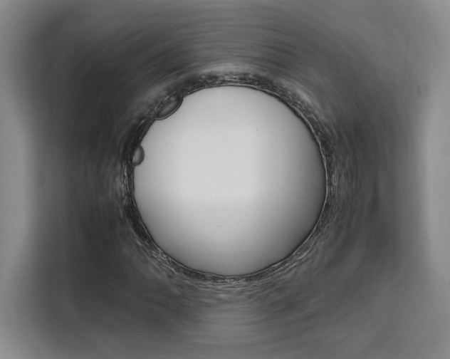 X0000111451062200907131036