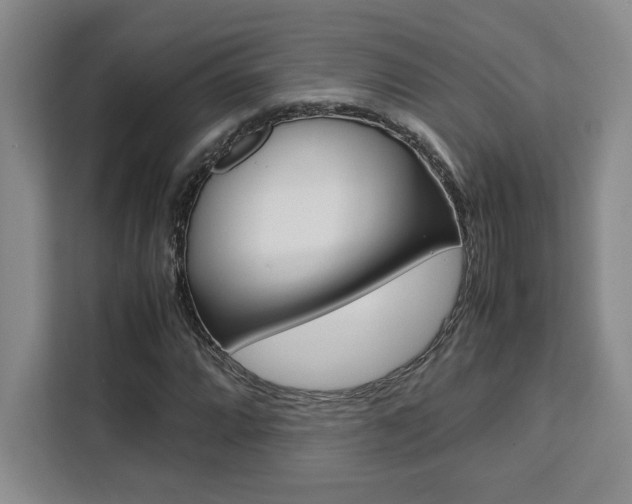 X0000111451064200907131036