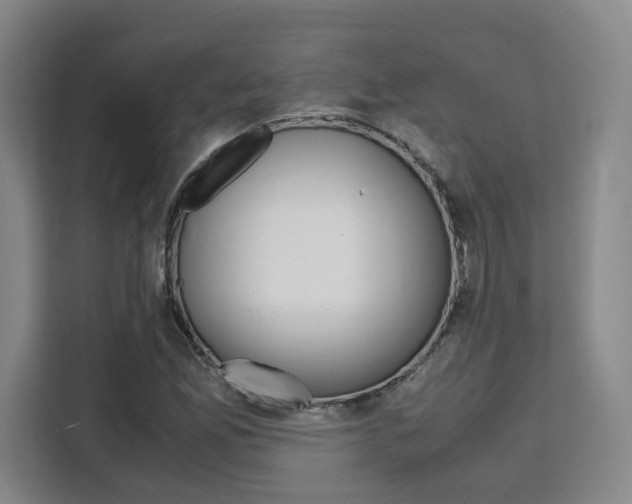 X0000111451165200907131035
