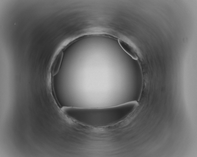 X0000111451472200907131031