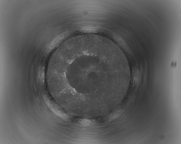 X0000111450494200907201053