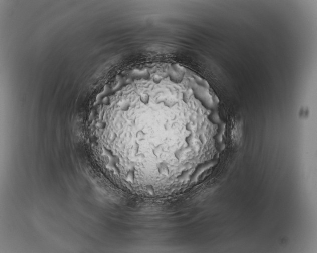 X0000111450819200907201047
