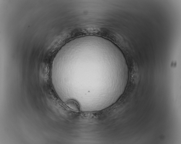 X0000111450866200907201047