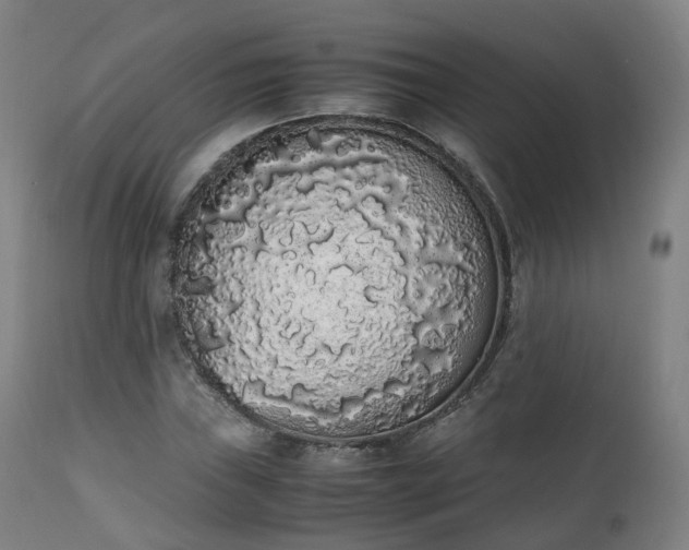 X0000111451019200907201044