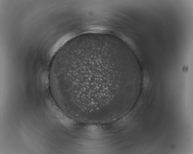X0000111451362200907201038
