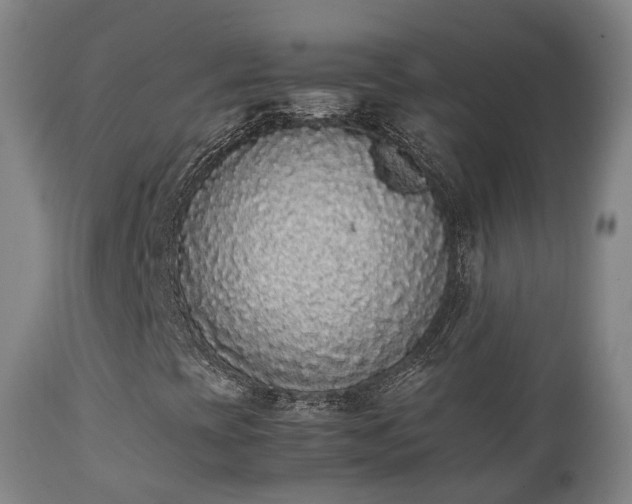 X0000111451393200907201037