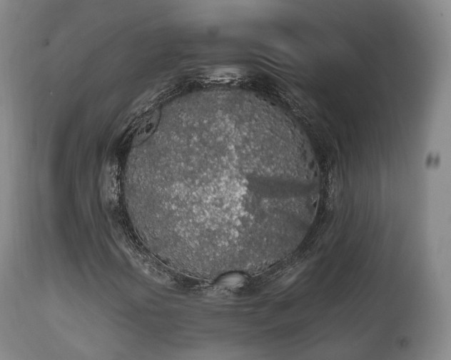 X0000111451394200907201037