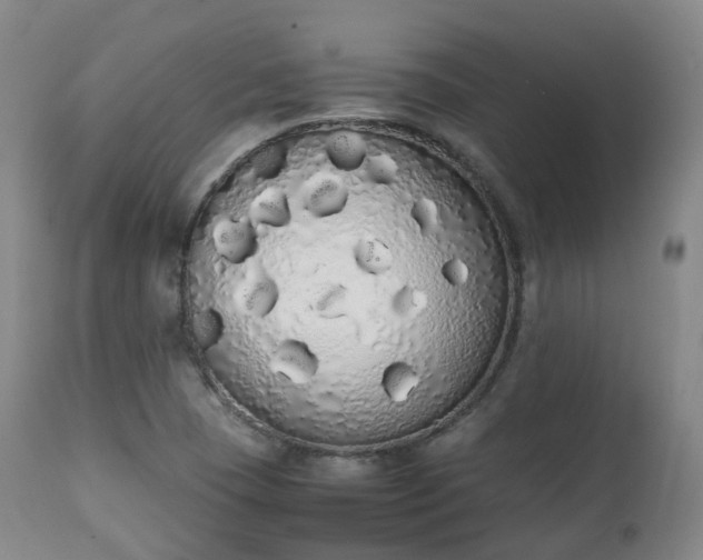 X0000111451409200907201037
