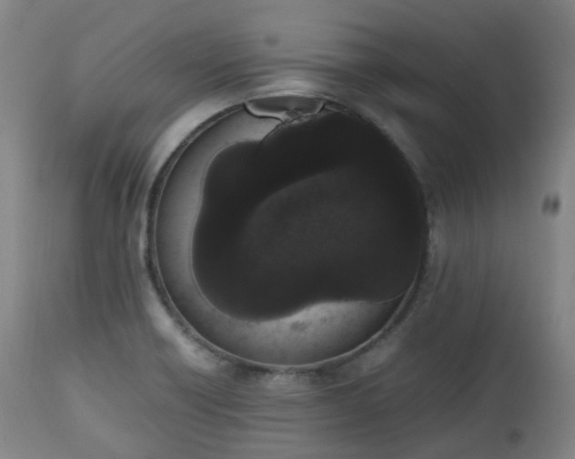 X0000111451418200907201038