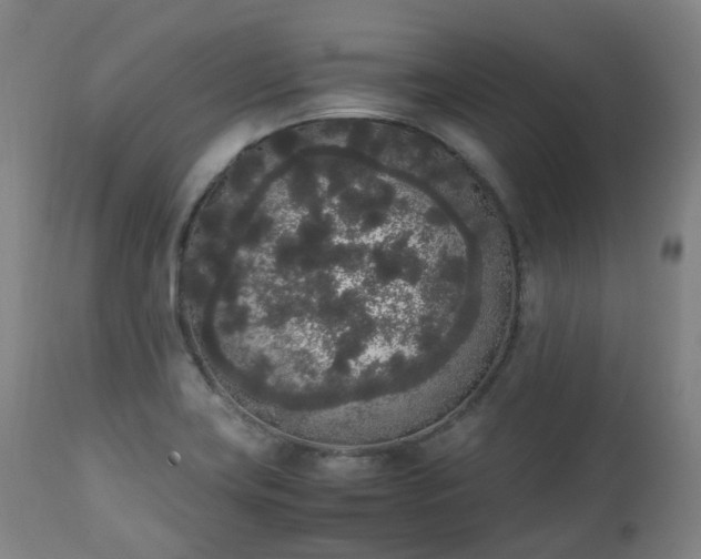 X0000111451419200907201038