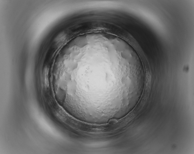 X0000111451439200907201038