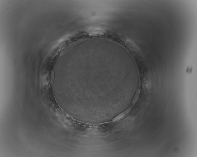 X0000111451445200907201037