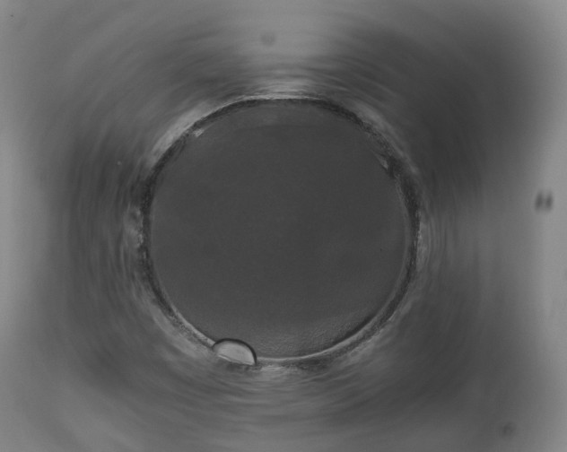 X0000111451449200907201037