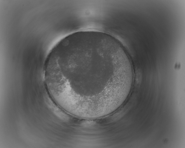 X0000111451462200907201037