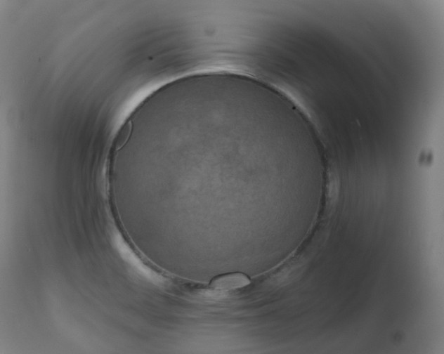 X0000111451468200907201037