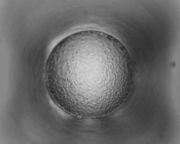 X0000111451527200907201036
