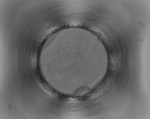 X0000111450496200908031417